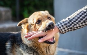 Dog Biting A Human Hand